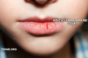 Ağız İçi Yaralara Ne İyi Gelir?