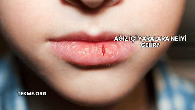 Ağız İçi Yaralara Ne İyi Gelir?