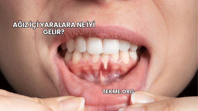Ağız İçi Yaralara Ne İyi Gelir?