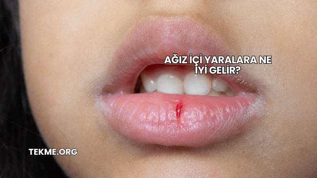 Ağız İçi Yaralara Ne İyi Gelir?