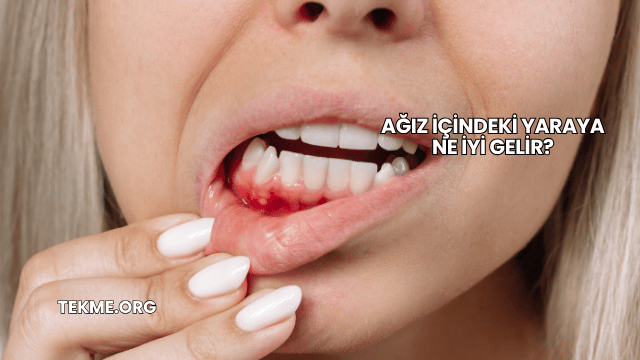 Ağız İçindeki Yaraya Ne İyi Gelir?