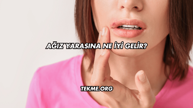 Ağız Yarasına Ne İyi Gelir?