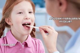 Ağızdaki Yaralara Ne İyi Gelir?