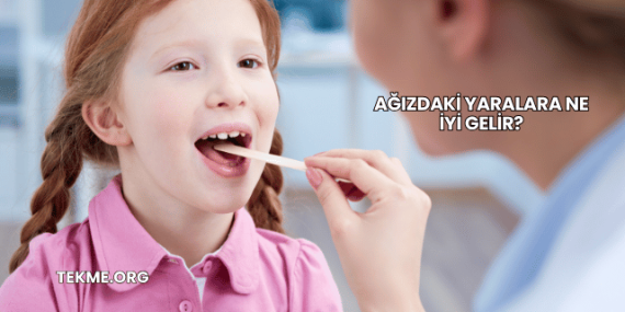 Ağızdaki Yaralara Ne İyi Gelir?