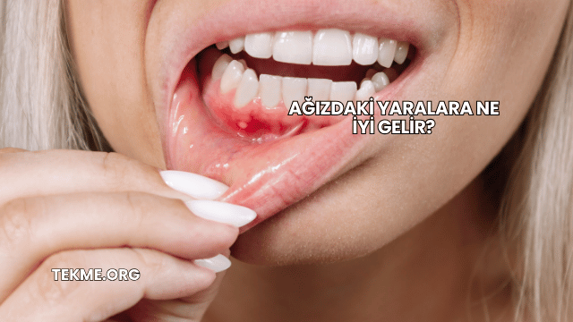 Ağızdaki Yaralara Ne İyi Gelir?