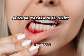 Ağızdaki Yaraya Ne İyi Gelir?