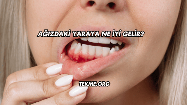 Ağızdaki Yaraya Ne İyi Gelir?