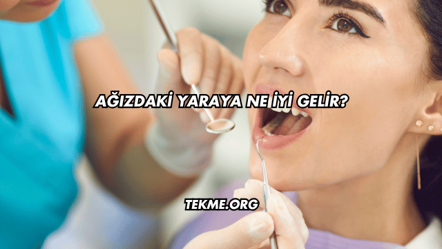 Ağızdaki Yaraya Ne İyi Gelir?