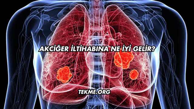 Akciğer İltihabına Ne İyi Gelir?
