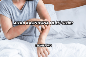 Alerji Kaşıntısına Ne İyi Gelir?