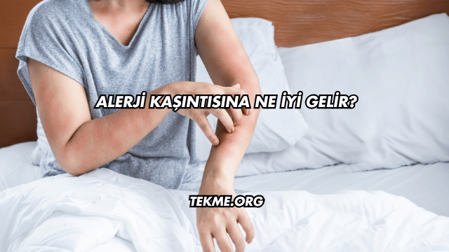 Alerji Kaşıntısına Ne İyi Gelir?