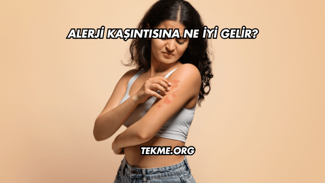 Alerji Kaşıntısına Ne İyi Gelir?