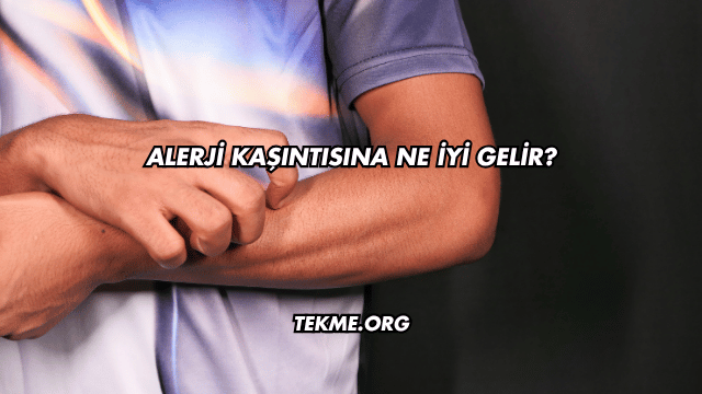 Alerji Kaşıntısına Ne İyi Gelir?