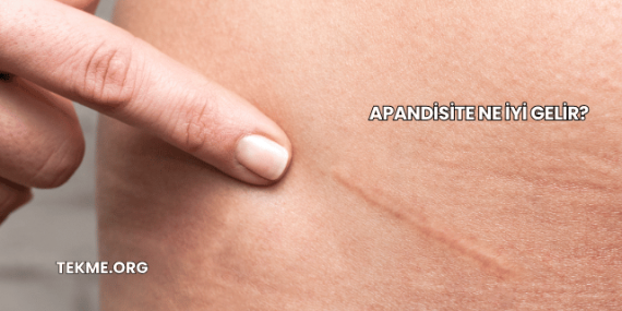 Apandisite Ne İyi Gelir?
