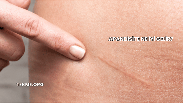 Apandisite Ne İyi Gelir?