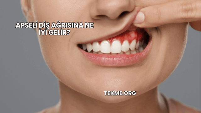 Apseli Diş Ağrısına Ne İyi Gelir?