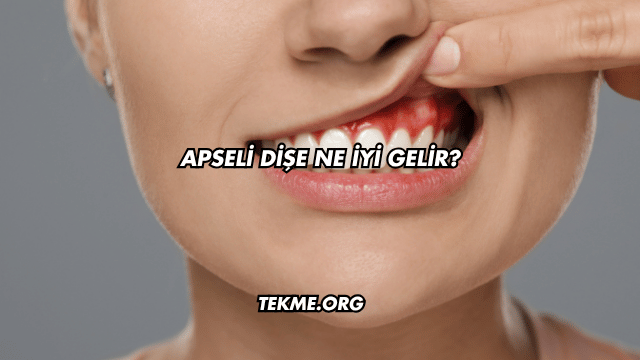 Apseli Dişe Ne İyi Gelir?