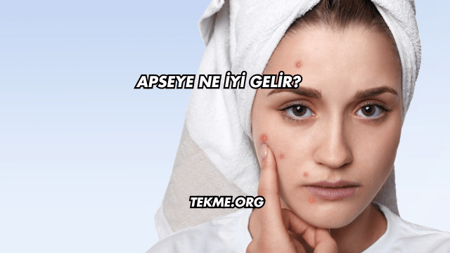 Apseye Ne İyi Gelir?