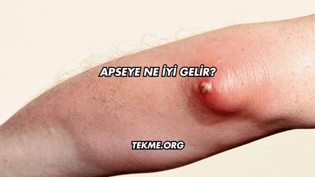 Apseye Ne İyi Gelir?