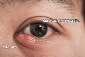 Arpacığa Ne İyi Gelir?