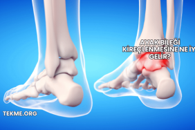 Ayak Bileği Kireçlenmesine Ne İyi Gelir?