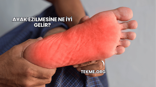 Ayak Ezilmesine Ne İyi Gelir?