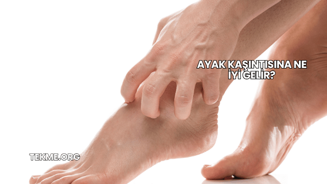 Ayak Kaşıntısına Ne İyi Gelir?