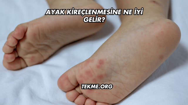 Ayak Kireçlenmesine Ne İyi Gelir?