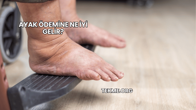Ayak Ödemine Ne İyi Gelir?