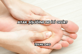 Ayak Şişliğine Ne İyi Gelir?