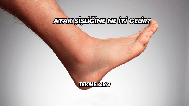 Ayak Şişliğine Ne İyi Gelir?