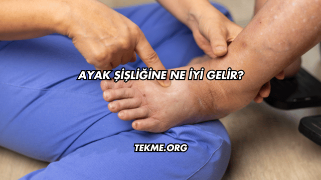 Ayak Şişliğine Ne İyi Gelir?