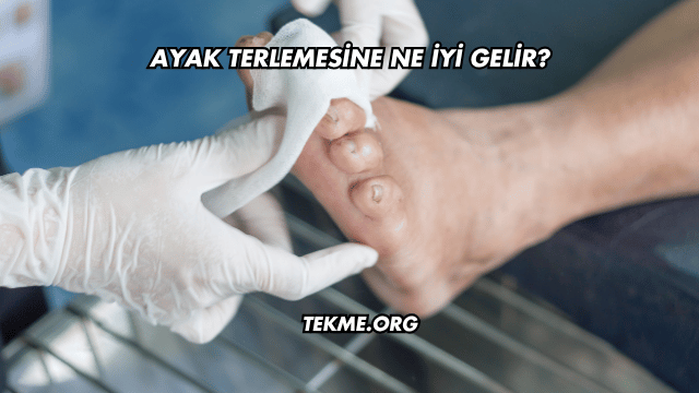 Ayak Terlemesine Ne İyi Gelir?
