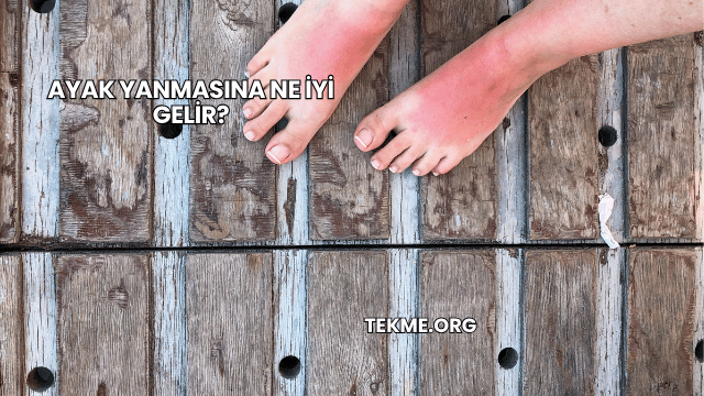 Ayak Yanmasına Ne İyi Gelir?