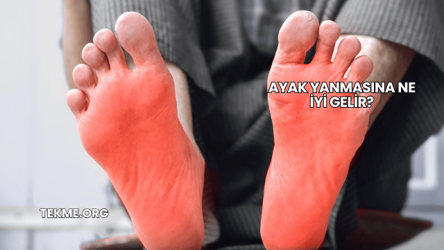 Ayak Yanmasına Ne İyi Gelir?