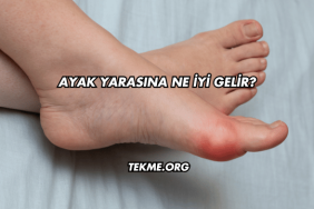 Ayak Yarasına Ne İyi Gelir?