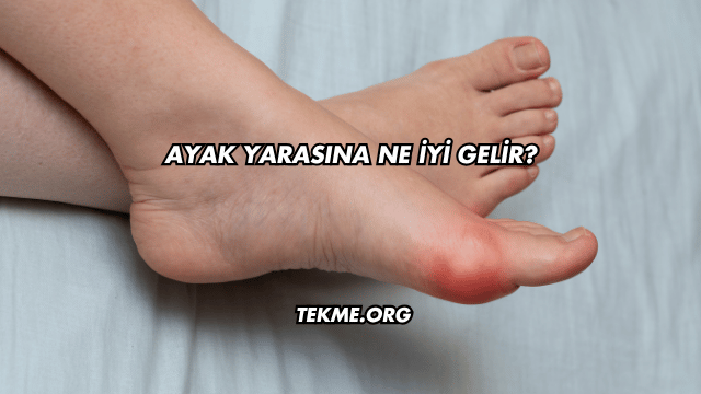 Ayak Yarasına Ne İyi Gelir?