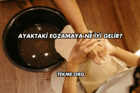 Ayaktaki Egzamaya Ne İyi Gelir?