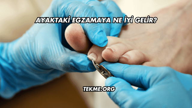 Ayaktaki Egzamaya Ne İyi Gelir?