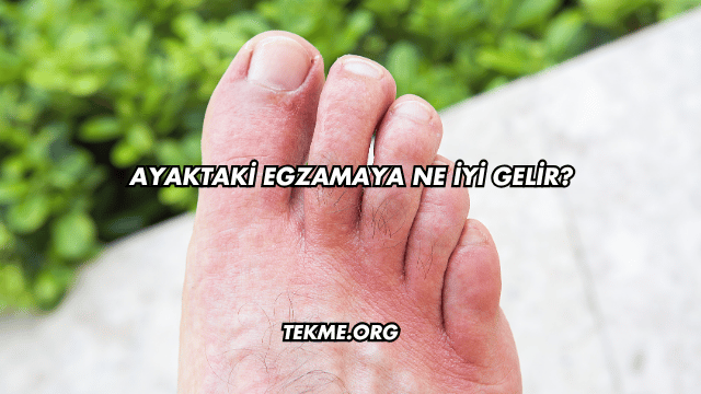 Ayaktaki Egzamaya Ne İyi Gelir?