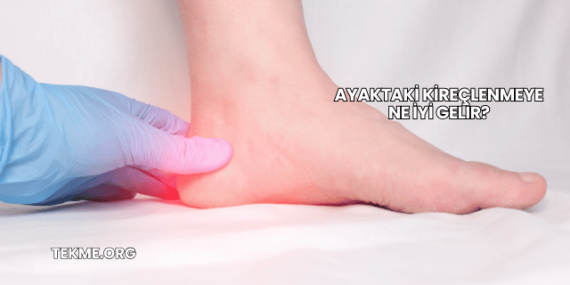 Ayaktaki Kireçlenmeye Ne İyi Gelir?