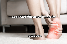 Ayaktaki Ödeme Ne İyi Gelir?