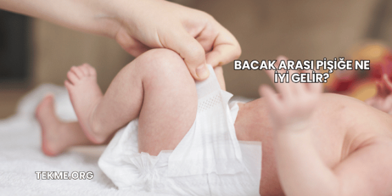 Bacak Arası Pişiğe Ne İyi Gelir?