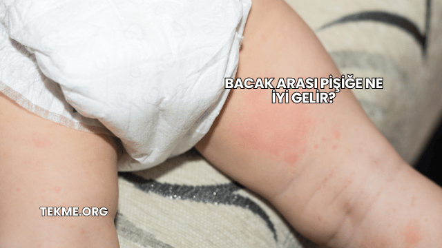 Bacak Arası Pişiğe Ne İyi Gelir?