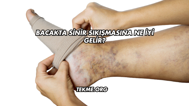 Bacakta Sinir Sıkışmasına Ne İyi Gelir?