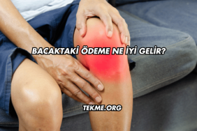 Bacaktaki Ödeme Ne İyi Gelir?