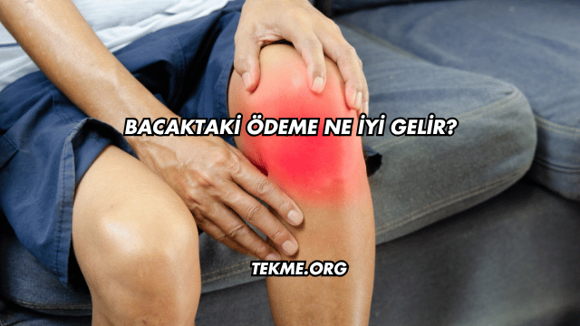 Bacaktaki Ödeme Ne İyi Gelir?