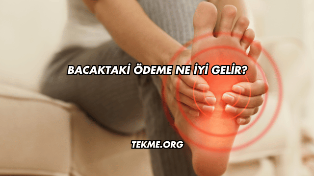 Bacaktaki Ödeme Ne İyi Gelir?