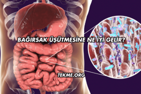 Bağırsak Üşütmesine Ne İyi Gelir