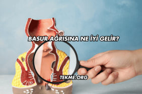 Basur Ağrısına Ne İyi Gelir?